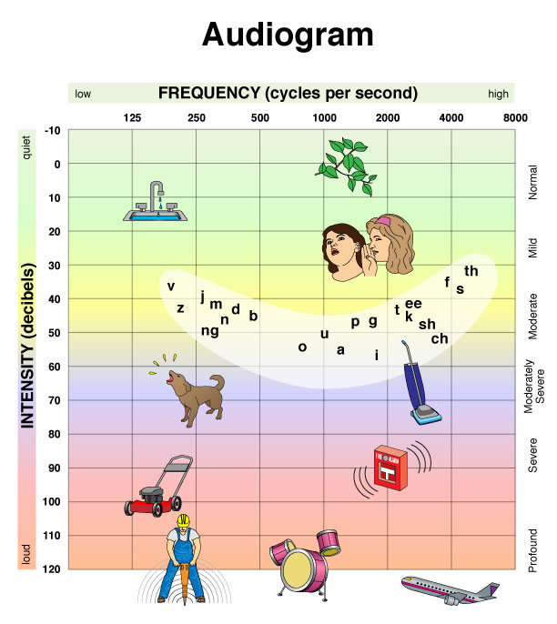 An audiogram example